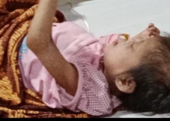 Bunga Hanya Bisa Terbaring Akibat Gizi Buruk Orang Tua Tidak mampu, Pemerintah Daerah Kabupaten Lebak Dimana ?