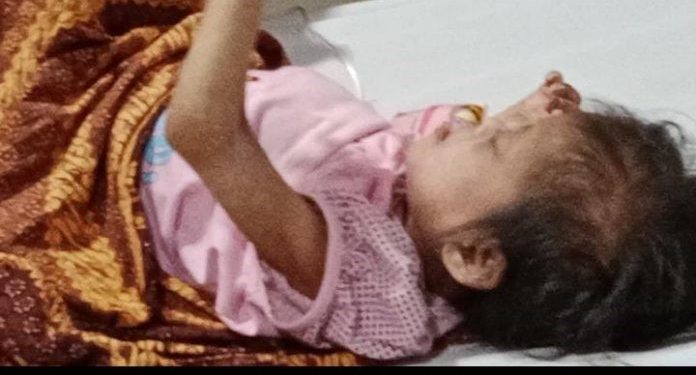 Bunga Hanya Bisa Terbaring Akibat Gizi Buruk Orang Tua Tidak mampu, Pemerintah Daerah Kabupaten Lebak Dimana ?